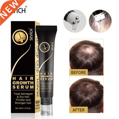 Sevich Hair Growth Oil Ginger Extract Growing Serum Prevent