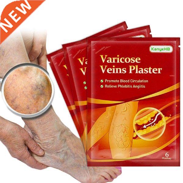 6Pcs/Set Veins Ointmnet Foot Care Repair Swelling Varicose