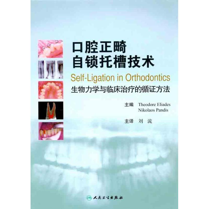 口腔正畸自锁托槽技术 生物力学与临床治疗的循方法刘流9787117137461