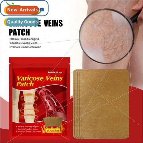 Vein Repair Patch Alleviates Varicose Leg PainWorm LegsBruis