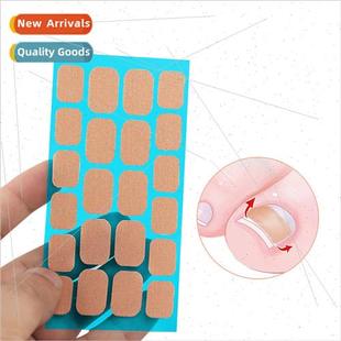 Stainless Steel Clip Ingrown Buckle Correction Inward Nail