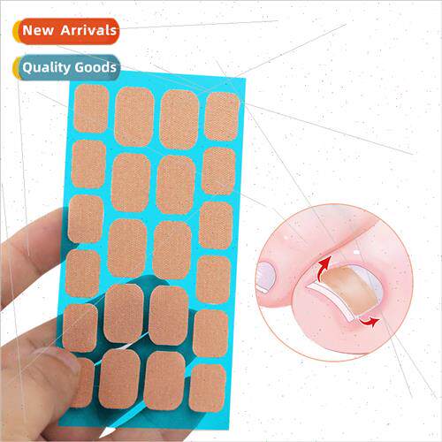 Ingrown Nail Correction Stainless Steel Clip & Buckle Inward