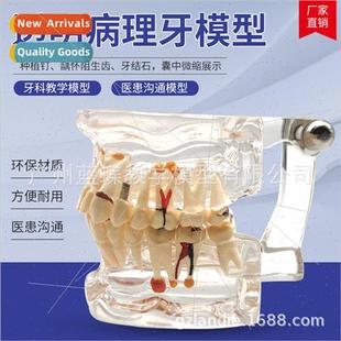 Pathology Mouth Dental Medical Com Transparent Teaching Full