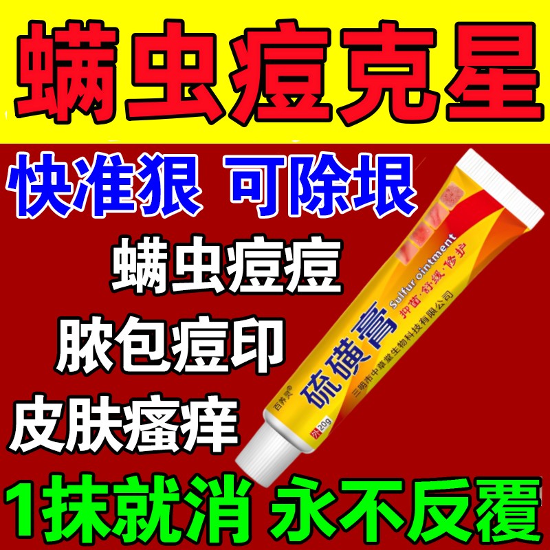 老牌子复方硫磺软膏螨虫药膏止特效痒阴虱疥虫后背螨虫除螨痘