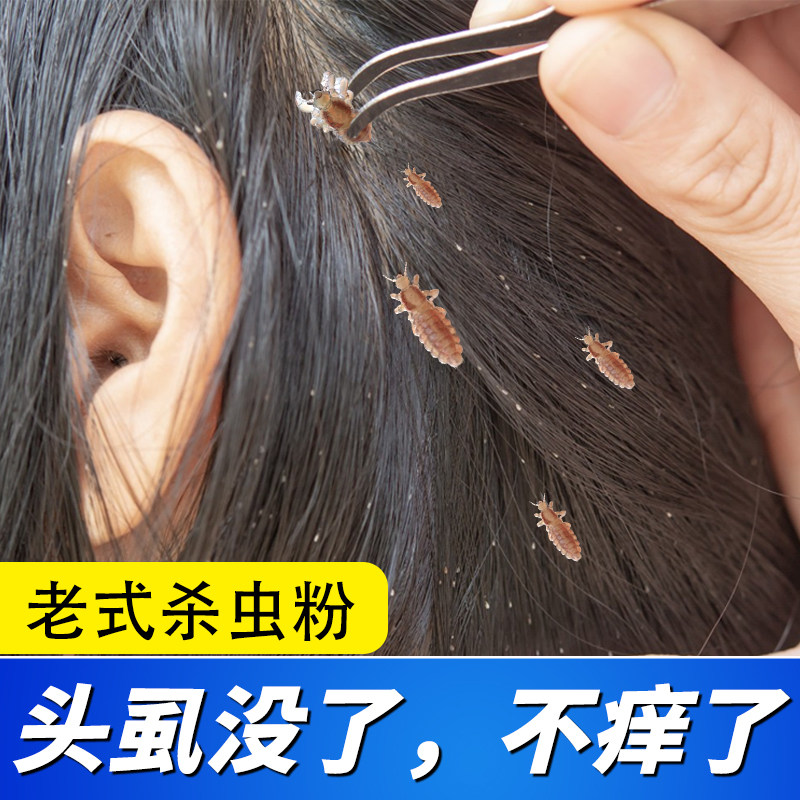 老式除头虱药粉虫卵双杀图片