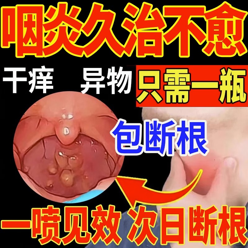 治疗烟炎慢性咽炎除根咽喉炎喉咙有异物感咳嗽干咳专用喷剂