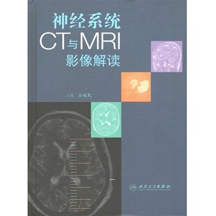 正版包邮神经系统CT与MRI影像解读全冠民　主编人民卫生出版社978