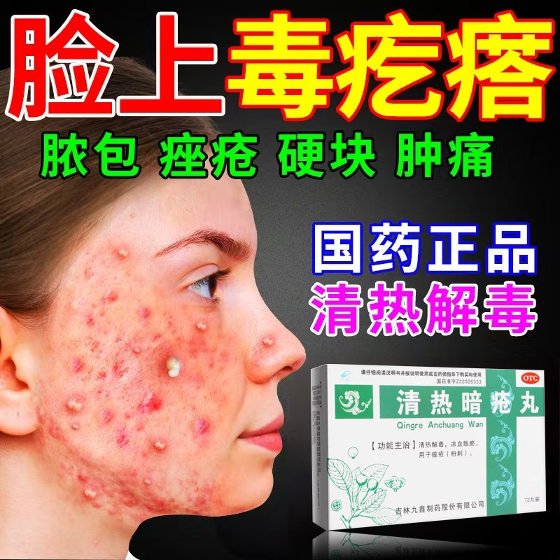 九鑫清热暗疮丸72丸/盒药品解毒痤疮丸皮脂汗腺泻火通腑凉血散瘀