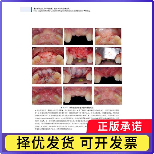 基于解剖分区的骨增量术:技术要点与临床决策:techniques and decision-making[以]Zvi Artzi9787504694539中国科学技术出版社