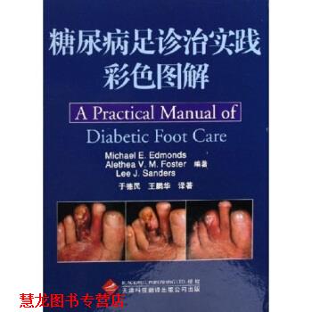 【正版书籍】 糖尿病足诊治实践彩色图解 [英] 埃德蒙斯,[英] 福斯特,[英] 桑德斯 著,于德民,王鹏华 译 天津科技翻译出版公司