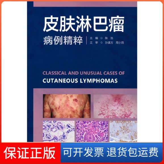 【保正版】皮肤淋巴瘤病例精粹陈浩北京大学医学出版社9787565927072