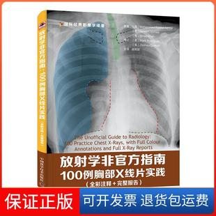 【保正版】放学非官方指南-100例胸部X线片实践-(全彩注释+完整报告)默罕默德.拉希德.阿克塔中国科技9787504673572