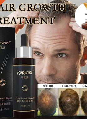 60ml Hair Growth Essence Dense Hair Growth Serum for Men/Wom