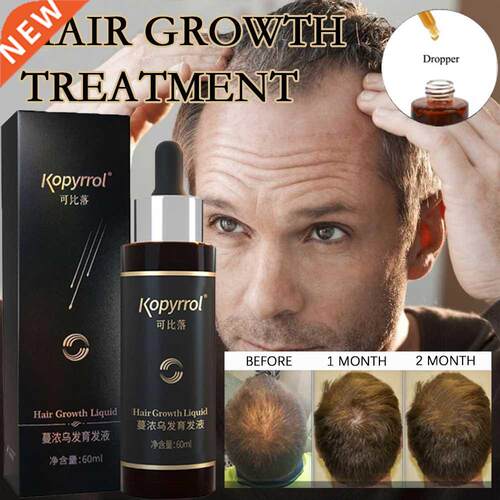 60ml Hair Growth Essence Dense Hair Growth Serum for Men/Wom