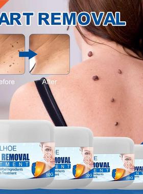 Wart Remover Safe Painless Skin Tags Removal Ointment Fast