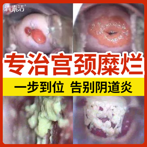 清素洁妇科栓剂医用凝胶正品敷料私处护理阴道炎宫颈糜烂治疗
