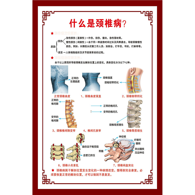 颈椎病的发病原因中医养生理疗馆墙贴画海报腰椎间盘病变突出病变