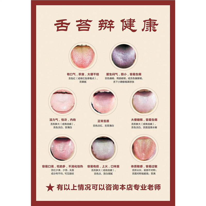中医舌苔辩健康海报诊面自粘图解舌苔对照图彩图版中医舌诊挂图