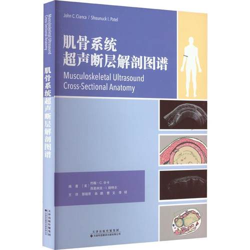 【文】 肌骨系统超声断层解剖图谱 9787543342170 天津科技翻译出版公司