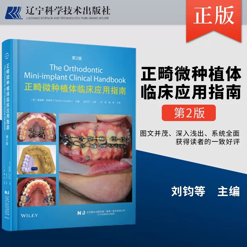 正畸微种植体临床应用指南 第2二版 单颗牙和前牙段的压低治疗 正畸微种植体原理与潜在的并发症 刘钧 杨秩译 辽宁科学技术出版社