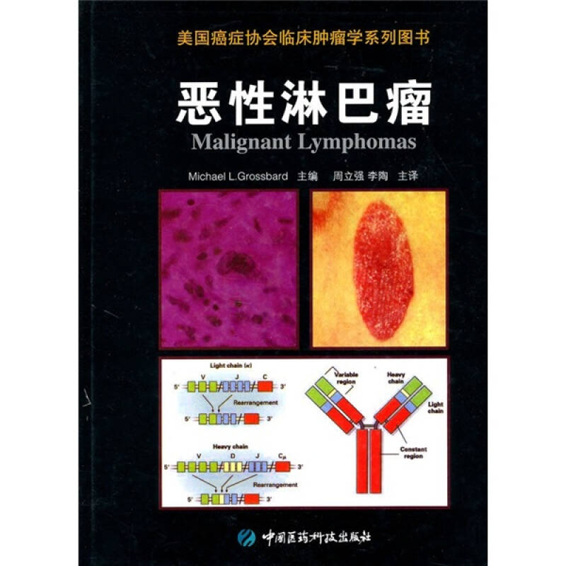 【正版书包邮】恶淋巴瘤(美) 格罗斯巴尔 (Grossbard中国医药科技出版社