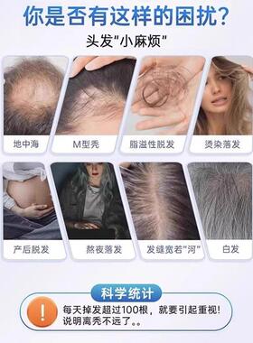 氨基发酸覆合发维生素片正品固FGP发养发强韧丝柔发亮秀护养根