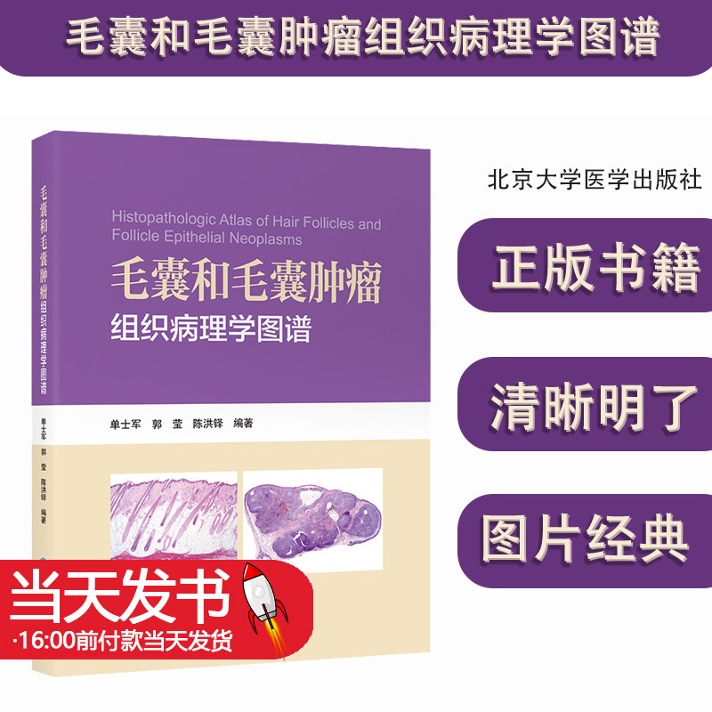 毛囊和毛囊肿瘤组织病理学图谱