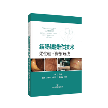 结肠镜操作技术:柔性轴平衡缩短法殷泙,方盛泉,王宜振上海科学技术出版社9787547870662医学卫生/肿瘤学