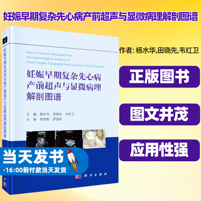 妊娠早期复杂先心病产前超声