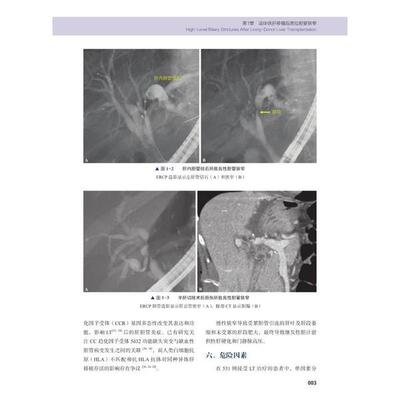 复杂疑难胆胰疾病高级ERCP教程李东基中国科学技术出版社9787504686466医学卫生/内科学
