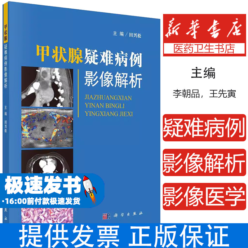 甲状腺疑难病例影像解析 田兴松 编 甲状腺恶性肿瘤 甲状腺转移性肿瘤 甲状腺超声 颈部CT 颈部MRI 甲状腺专科医师参考实用型书籍