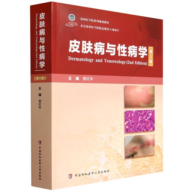 皮肤病与性病学(第2版)编者:晋红中|中国协和医科大学9787567925922医学卫生/皮肤病学/性病学