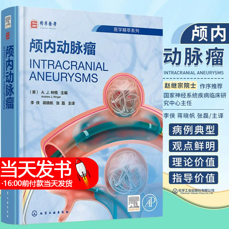 颅内动脉瘤 脑血管病颅内动脉瘤介入治疗全面指导 颅内动脉瘤流行病学 颅内动脉瘤胚胎学病理学 脑血管病救治医护人员参考指南