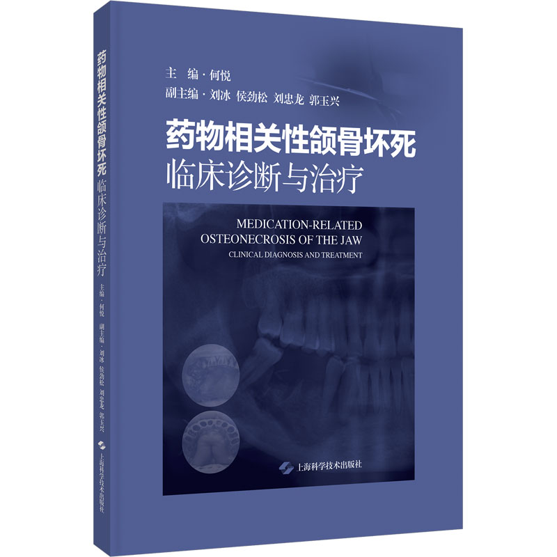 药物相关性颌骨坏死临床诊断与治疗何悦上海科学技术出版社医学卫生外科学口腔颌面外科并发症诊疗抗骨吸收药物专家共识解读临床实