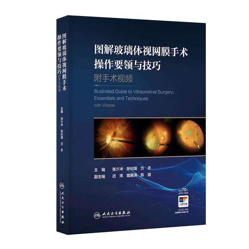 图解玻璃体视网膜手术操作要领与技巧 附手术视频 张少冲 张钊填 方冬 主编 参考书 眼科学 西医 9787117403016 人民卫生出版社
