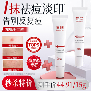 20%壬二酸祛痘精华液祛痘去黑头闭口粉刺控油收缩毛孔粉刺涂抹