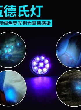 WOOD's Lamp Fungus Test Lamp Light Skin ltraviolet Light