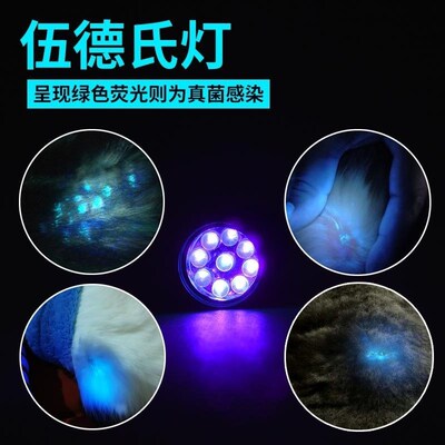 WOOD's Lamp Fungus Test Lamp Light Skin ltraviolet Light