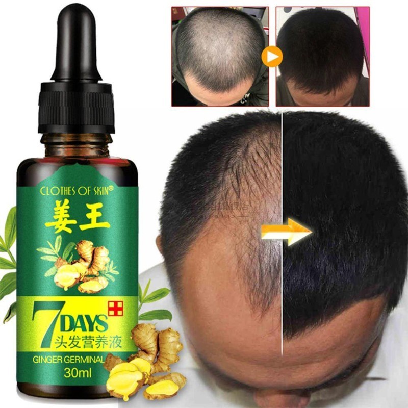 1PC Fertilizer  Hair Growth Serum Essence   And Wo Fluid Hai