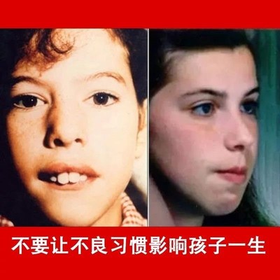 X-shaped mouth tape to prevent mouth opening breathing corre