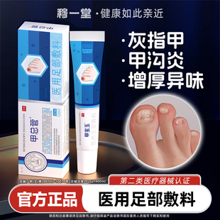 甲总管医用足部敷料甲宝玉凝胶灰指甲膏甲沟炎趾发黄变厚红肿痛痒