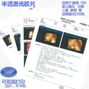 半透明激光医用打印胶片彩色激光双面打印胶片B超彩超胃镜科室用