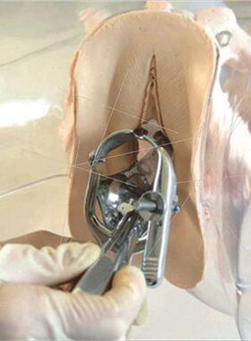 Transparent Curettage Model Curettage Model Female Abortion