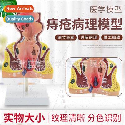 anorectal disease model human rectal pathology model anal fl