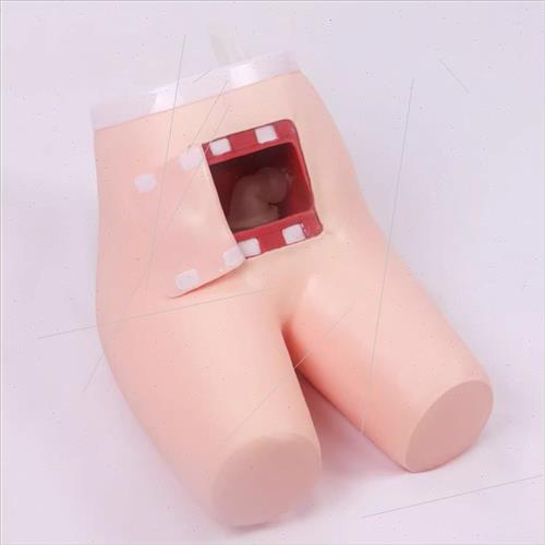 Advanced Assisted Defecation Enema Exercises Assisted Defeca