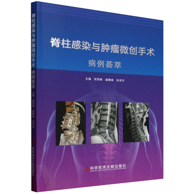 正版包邮 脊柱感染与肿瘤微创手术病例荟萃 主编张西峰, 虞攀峰, 张泽华 9787523522974 科学技术文献出版社