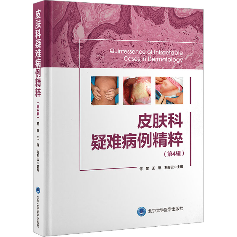 皮肤科疑难病例精粹(第4辑) 专业病例 临床经验 解析 实用技巧 高清图片 经典案例 疑难解析 医学知识 临床指导9787565927409