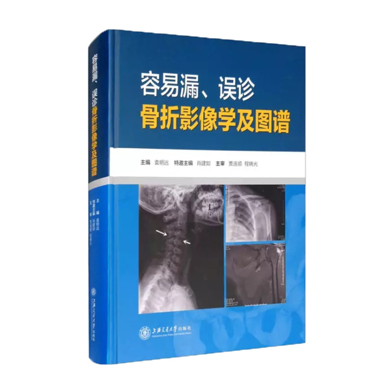 容易漏、误诊骨折影像学及图谱 漏诊误诊分析 骨折影像诊断 临床图谱 影像技巧 骨科医师 医学生用书 全彩插图 9787313235770