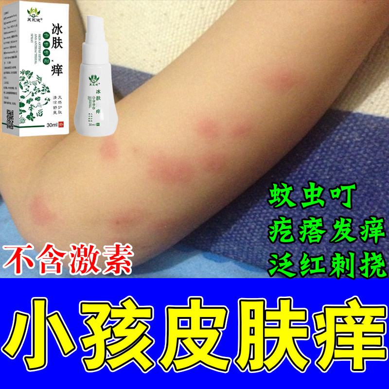 冶小孩长红疙瘩蚊虫叮咬痒肿挠身上起红疙瘩小腿痒发红草本喷剂