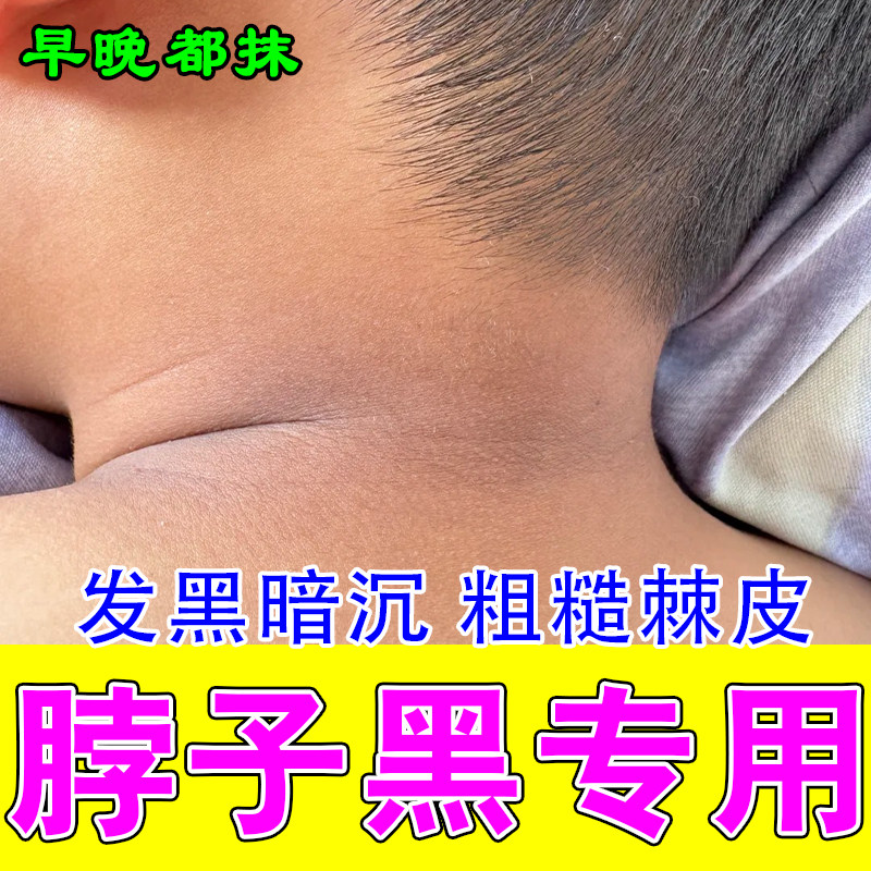 黑脖子粗糙皮肤神器黑棘皮黑黑的洗不干净腋下黑脖子黑修护按摩膏